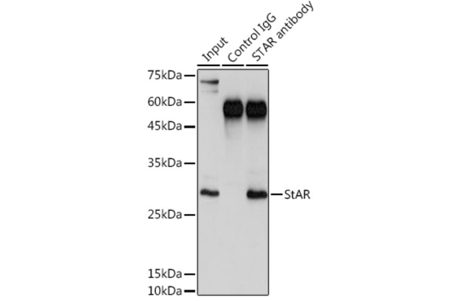 Western Blot - Anti-StAR Antibody (A12903) - Antibodies.com