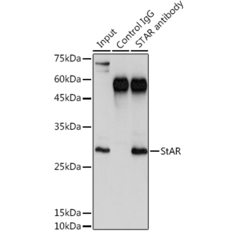 Western Blot - Anti-StAR Antibody (A12903) - Antibodies.com