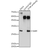 Western Blot - Anti-StAR Antibody (A12903) - Antibodies.com