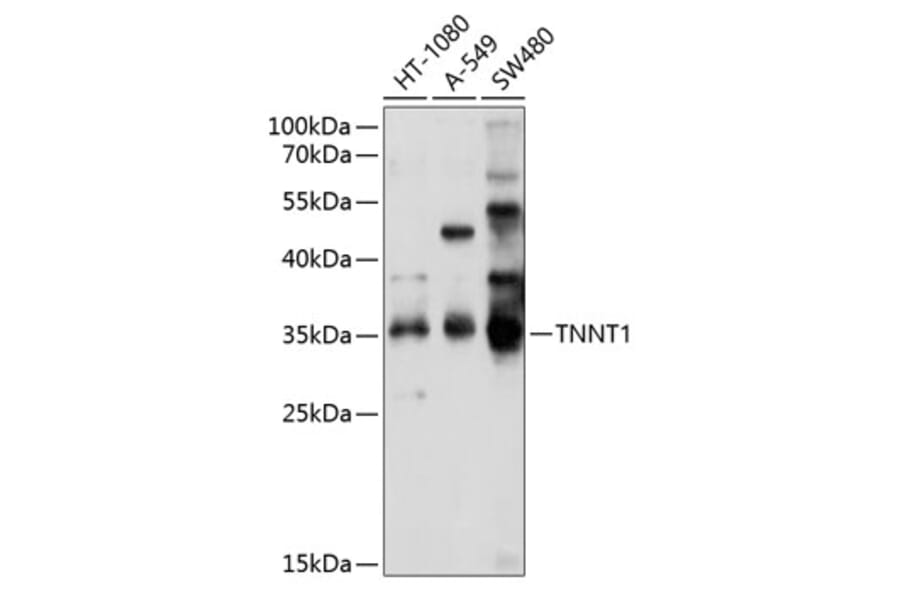 Western Blot - Anti-Troponin T1/TNT Antibody (A12904) - Antibodies.com