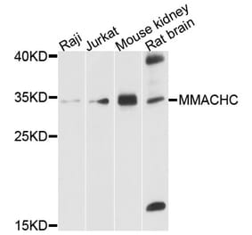 Western Blot - Anti-MMACHC Antibody (A10355) - Antibodies.com