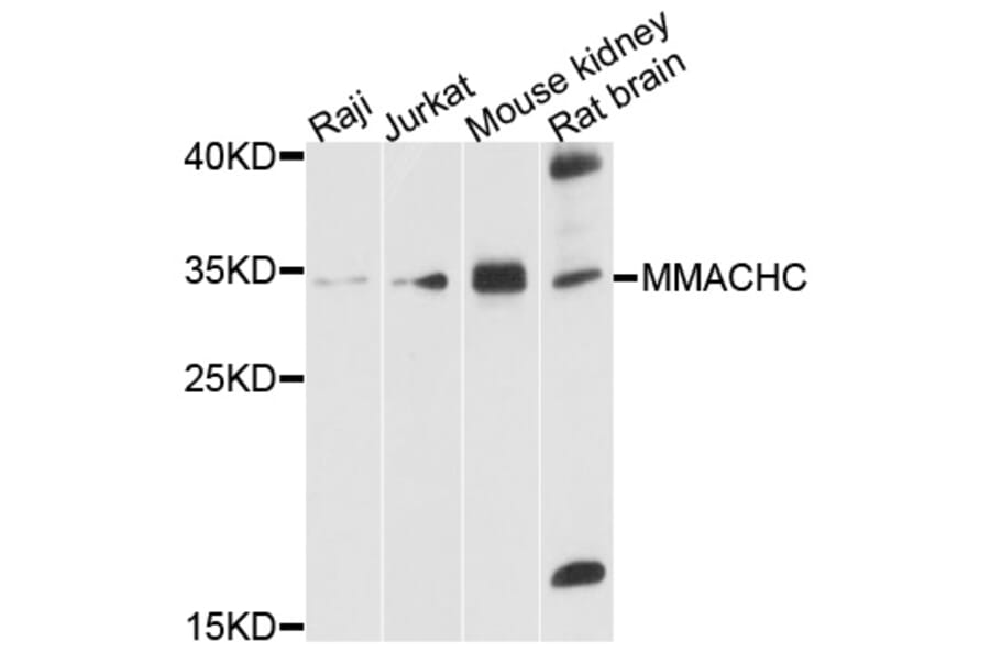 Western Blot - Anti-MMACHC Antibody (A10355) - Antibodies.com