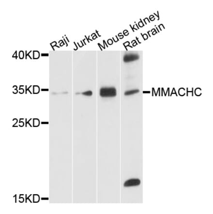 Western Blot - Anti-MMACHC Antibody (A10355) - Antibodies.com