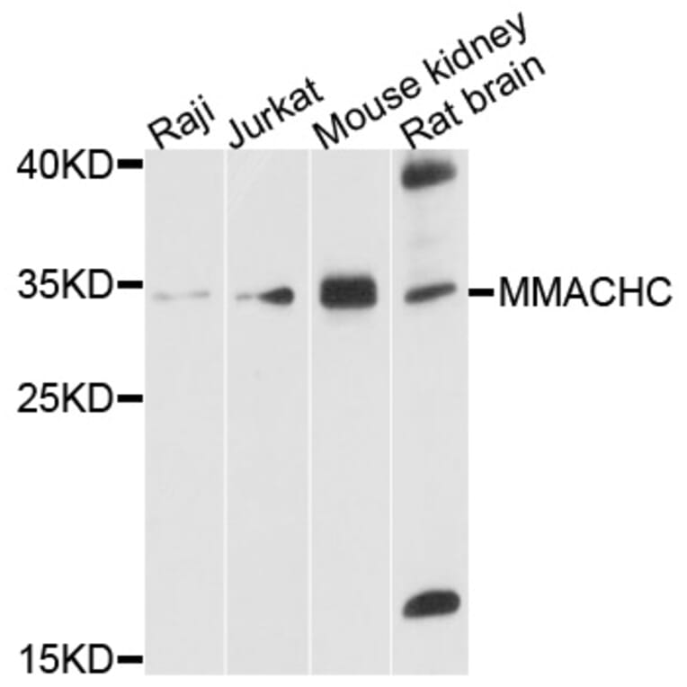 Western Blot - Anti-MMACHC Antibody (A10355) - Antibodies.com