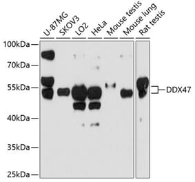 Western Blot - Anti-DDX47 Antibody (A12907) - Antibodies.com