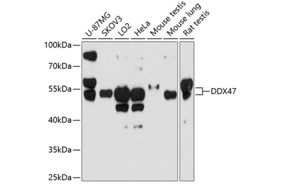 Western Blot - Anti-DDX47 Antibody (A12907) - Antibodies.com