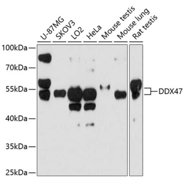 Western Blot - Anti-DDX47 Antibody (A12907) - Antibodies.com