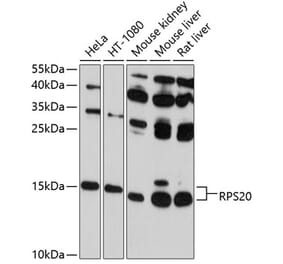 Western Blot - Anti-RPS20 Antibody (A12908) - Antibodies.com