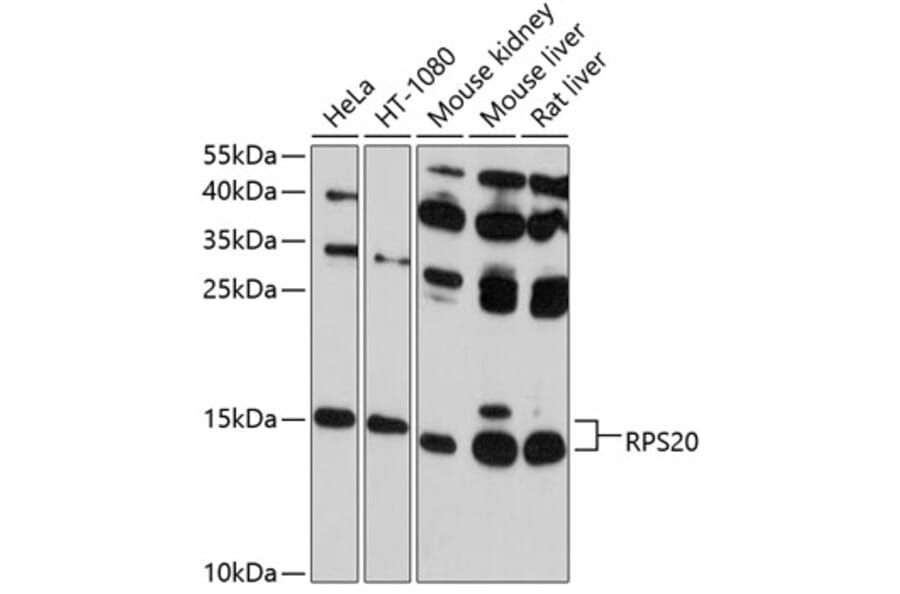 Western Blot - Anti-RPS20 Antibody (A12908) - Antibodies.com