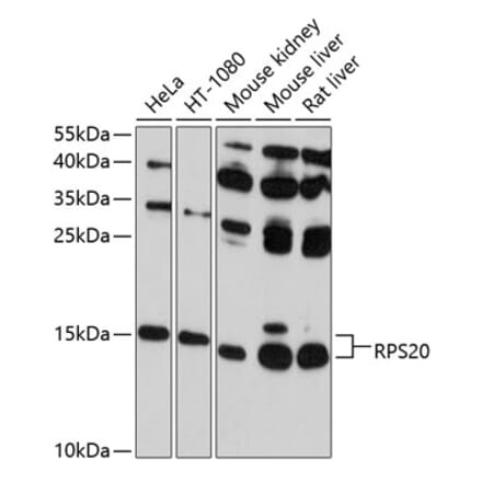 Western Blot - Anti-RPS20 Antibody (A12908) - Antibodies.com