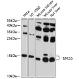 Western Blot - Anti-RPS20 Antibody (A12908) - Antibodies.com