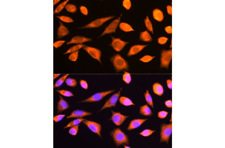 Immunofluorescence - Anti-RPS20 Antibody (A12908) - Antibodies.com
