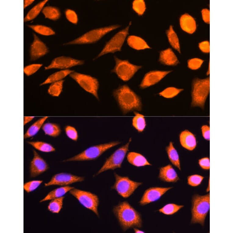 Immunofluorescence - Anti-RPS20 Antibody (A12908) - Antibodies.com