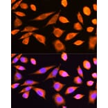 Immunofluorescence - Anti-RPS20 Antibody (A12908) - Antibodies.com