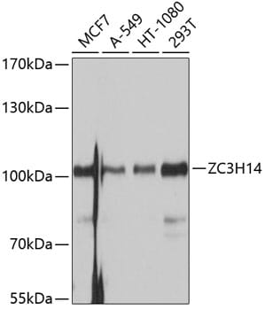 Western blot analysis of extracts of various cell lines, using Anti-ZC3H14 Antibody (A10364) at 1:1,000 dilution.
Secondary antibody: Goat Anti-Rabbit IgG (H+L) (HRP) (AS014) at 1:10,000 dilution.
Lysates / proteins: 25µg per lane.
Blocking buffer: 3% non-fat dry milk in TBST.
Detection: ECL Basic Kit (RM00020).
Exposure time: 1s.