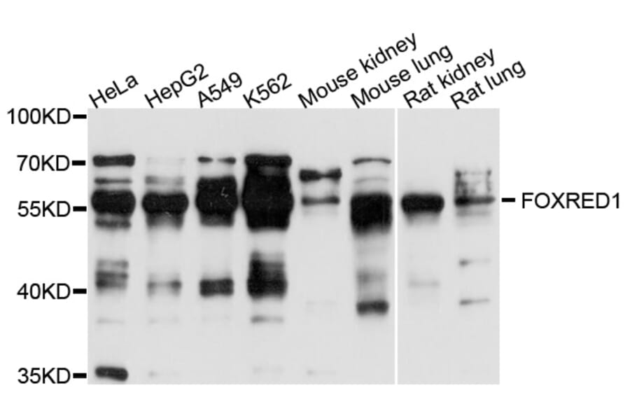 Western Blot - Anti-FOXRED1 Antibody (A10369) - Antibodies.com
