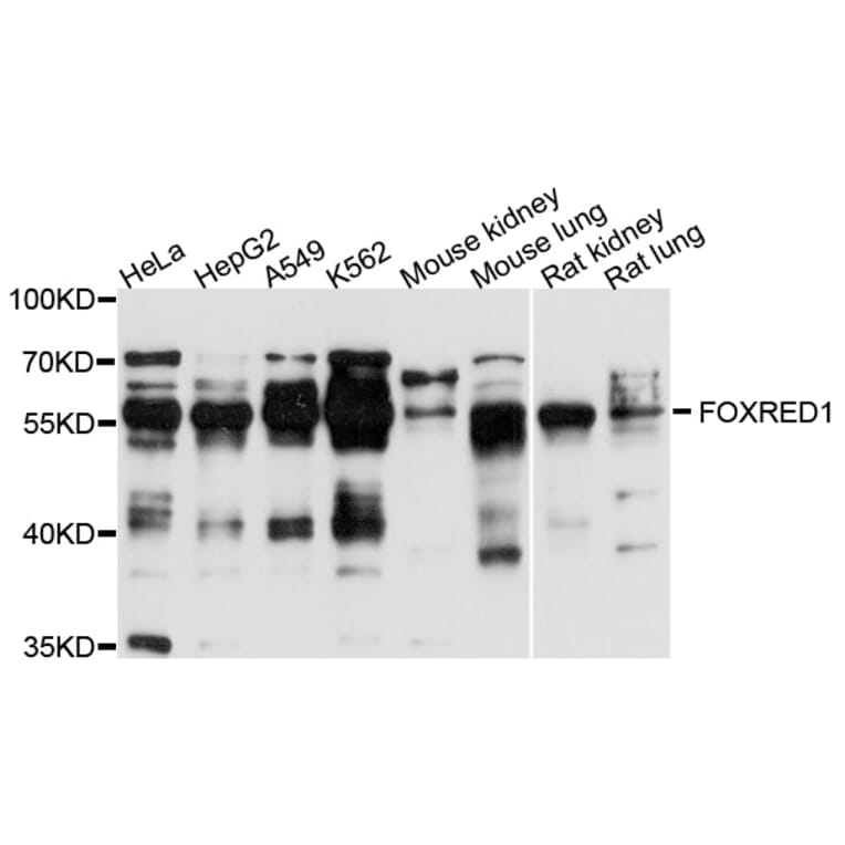 Western Blot - Anti-FOXRED1 Antibody (A10369) - Antibodies.com