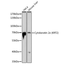 Western Blot - Anti-Cytokeratin 2e Antibody (A12911) - Antibodies.com