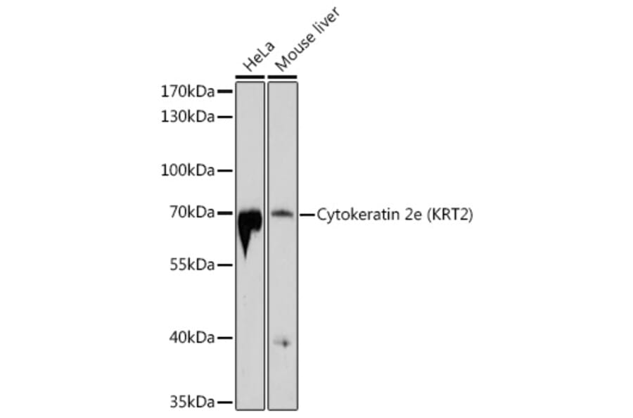 Western Blot - Anti-Cytokeratin 2e Antibody (A12911) - Antibodies.com