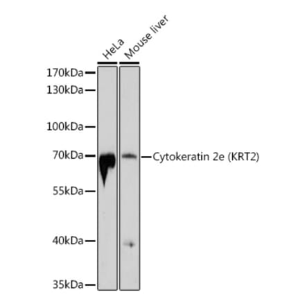 Western Blot - Anti-Cytokeratin 2e Antibody (A12911) - Antibodies.com