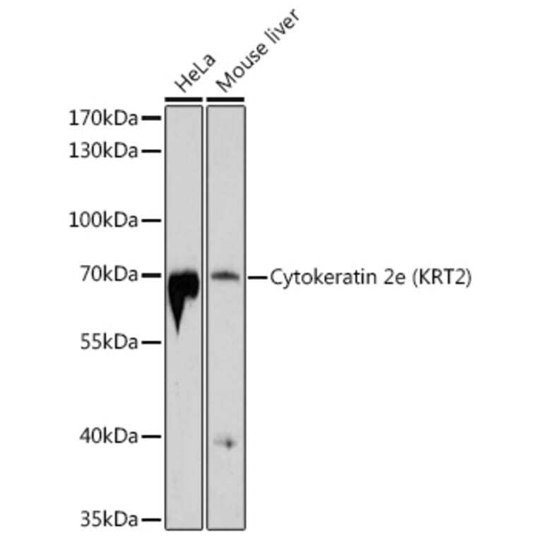 Western Blot - Anti-Cytokeratin 2e Antibody (A12911) - Antibodies.com