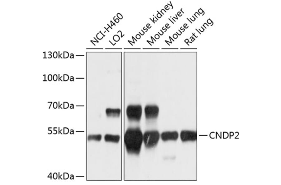 Western Blot - Anti-CNDP2/CN2 Antibody (A12912) - Antibodies.com