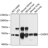 Western Blot - Anti-CNDP2/CN2 Antibody (A12912) - Antibodies.com