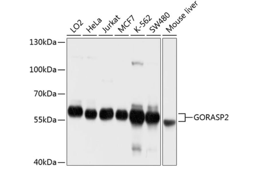 Western Blot - Anti-GORASP2/GRASP55 Antibody (A12914) - Antibodies.com