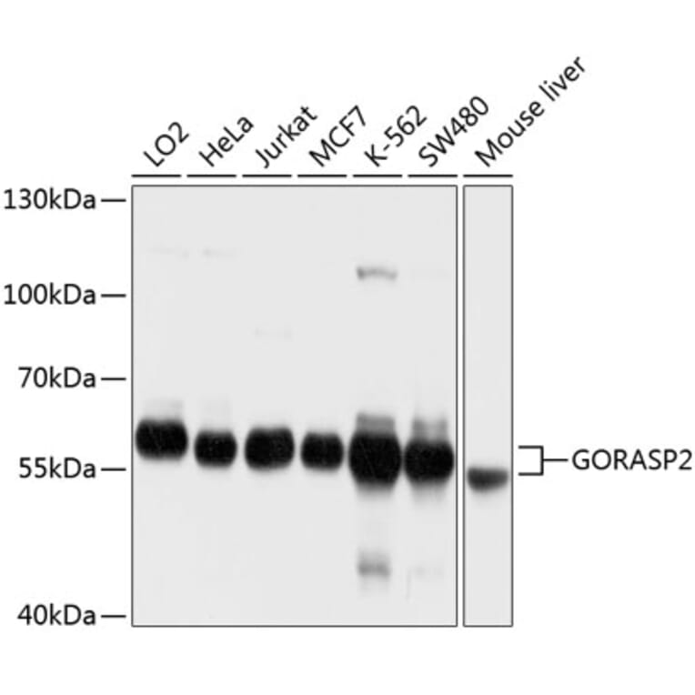 Western Blot - Anti-GORASP2/GRASP55 Antibody (A12914) - Antibodies.com