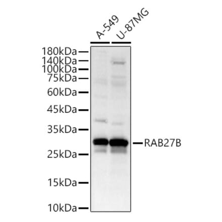 Western Blot - Anti-RAB27B Antibody (A12915) - Antibodies.com