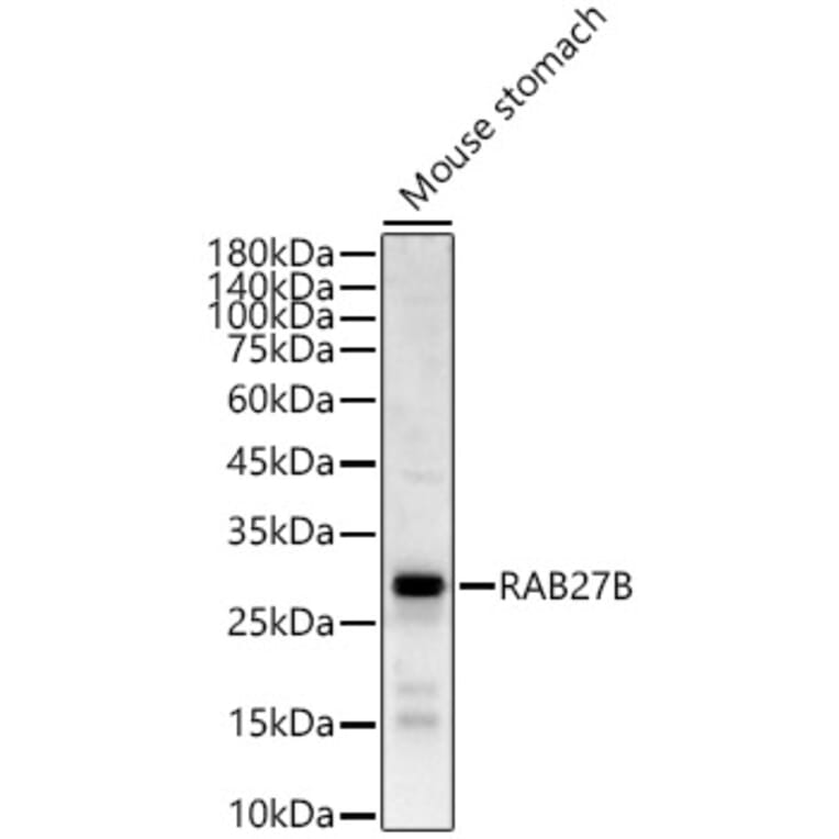 Western Blot - Anti-RAB27B Antibody (A12915) - Antibodies.com