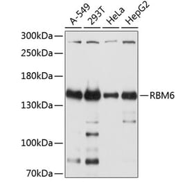 Western Blot - Anti-RBM6 Antibody (A12916) - Antibodies.com