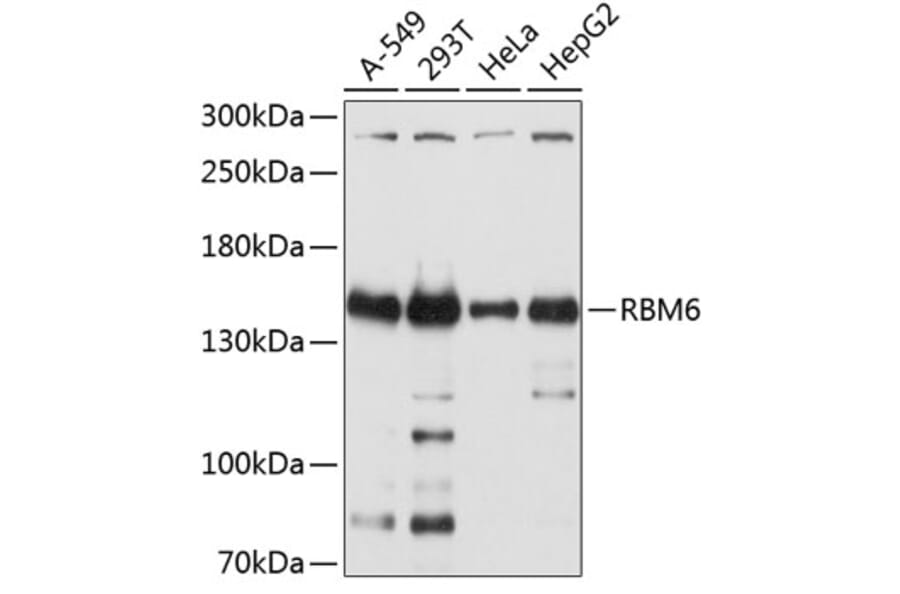 Western Blot - Anti-RBM6 Antibody (A12916) - Antibodies.com