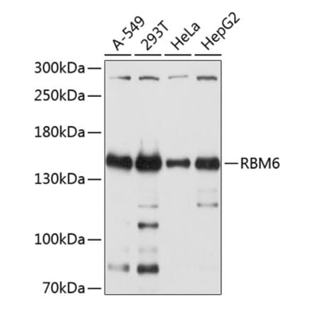 Western Blot - Anti-RBM6 Antibody (A12916) - Antibodies.com