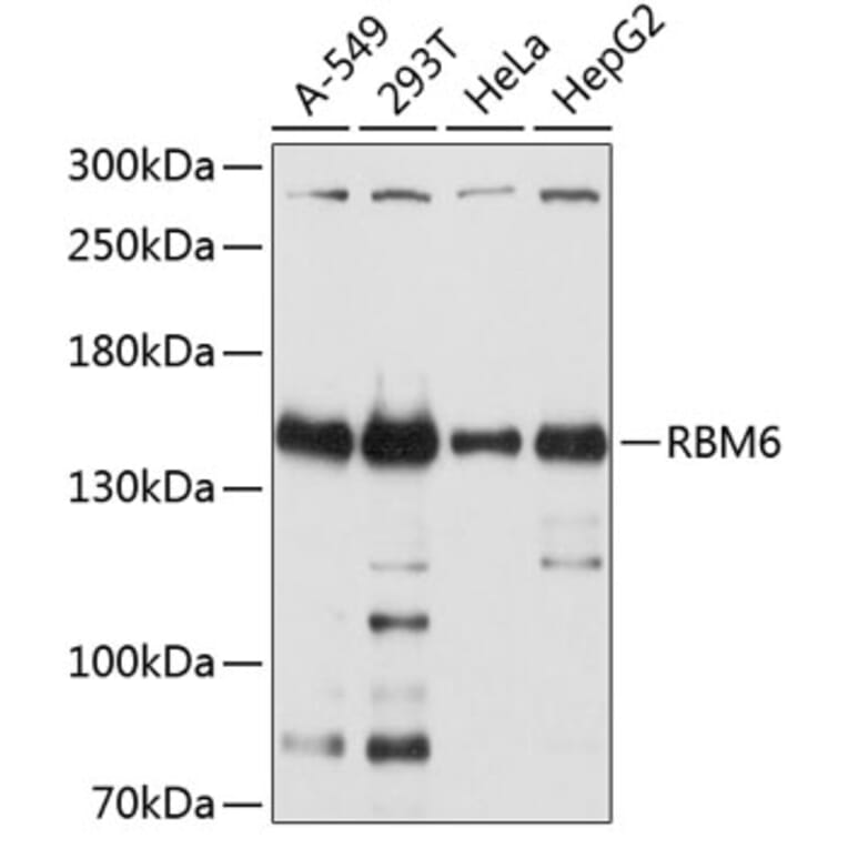 Western Blot - Anti-RBM6 Antibody (A12916) - Antibodies.com