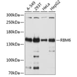 Western Blot - Anti-RBM6 Antibody (A12916) - Antibodies.com