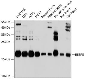 Western Blot - Anti-REEP5 Antibody (A12917) - Antibodies.com