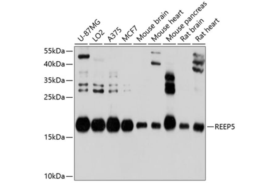 Western Blot - Anti-REEP5 Antibody (A12917) - Antibodies.com