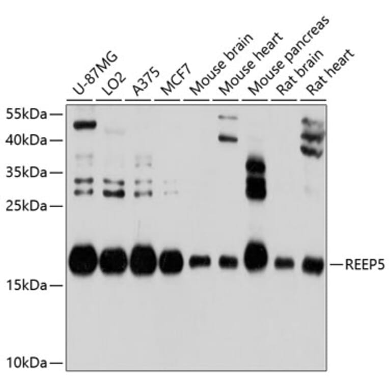 Western Blot - Anti-REEP5 Antibody (A12917) - Antibodies.com