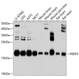 Western Blot - Anti-REEP5 Antibody (A12917) - Antibodies.com