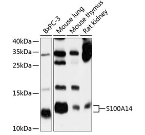Western Blot - Anti-S100A14 Antibody (A12919) - Antibodies.com