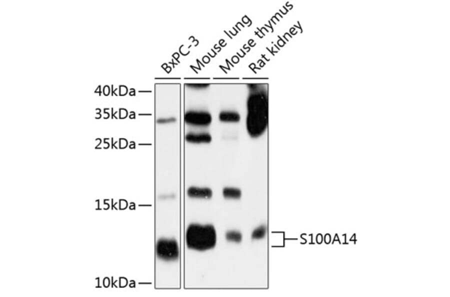 Western Blot - Anti-S100A14 Antibody (A12919) - Antibodies.com