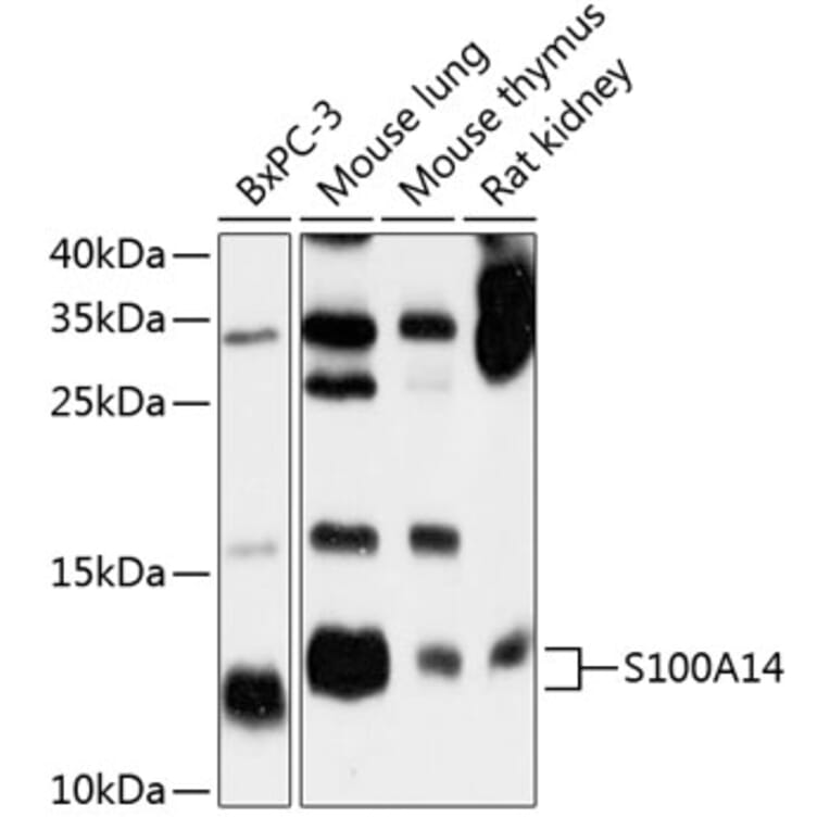 Western Blot - Anti-S100A14 Antibody (A12919) - Antibodies.com