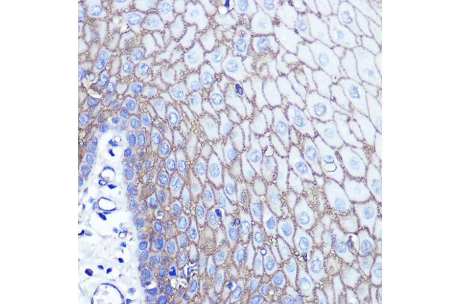 Immunohistochemistry - Anti-S100A14 Antibody (A12919) - Antibodies.com