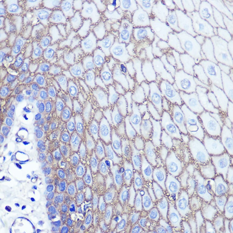 Immunohistochemistry - Anti-S100A14 Antibody (A12919) - Antibodies.com