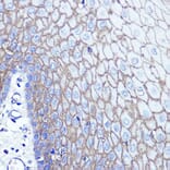 Immunohistochemistry - Anti-S100A14 Antibody (A12919) - Antibodies.com