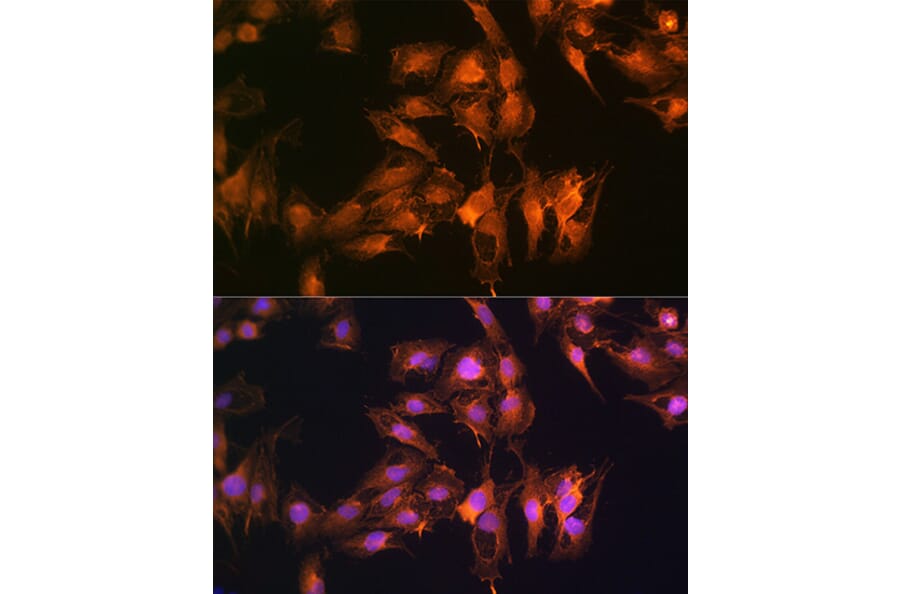Immunofluorescence - Anti-S100A14 Antibody (A12919) - Antibodies.com