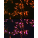 Immunofluorescence - Anti-S100A14 Antibody (A12919) - Antibodies.com