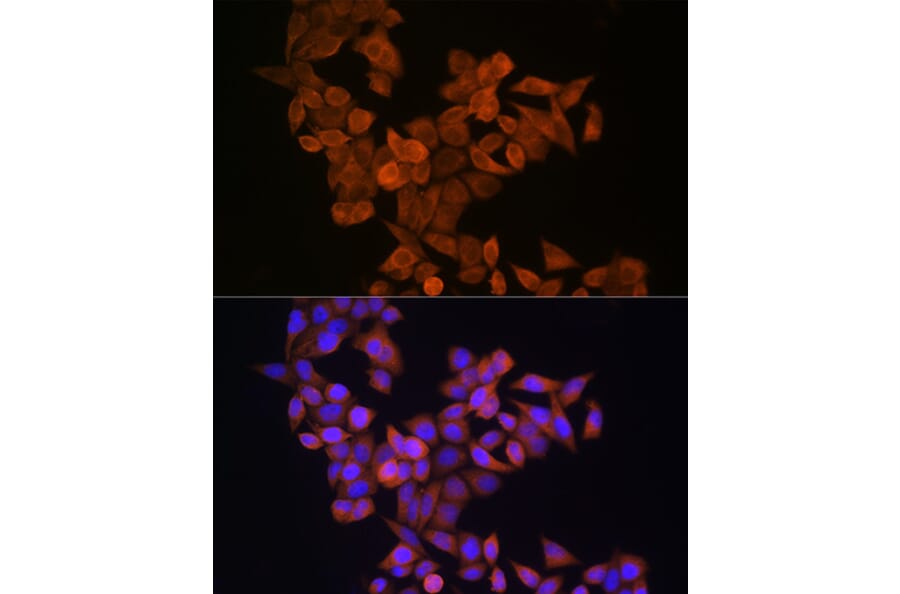 Immunofluorescence - Anti-S100A14 Antibody (A12919) - Antibodies.com