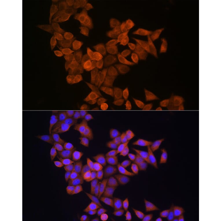 Immunofluorescence - Anti-S100A14 Antibody (A12919) - Antibodies.com